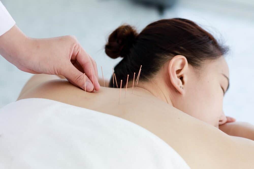 Women's health acupuncture — PMOS, menopause, and hormonal balance at Health Pointe Jacksonville, FL