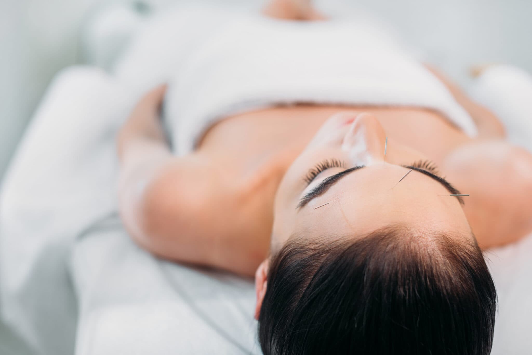 Woman relaxing during acupuncture facial treatment at Health Pointe Jacksonville
