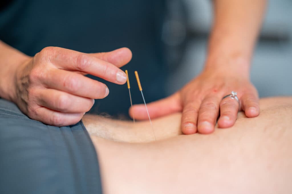 Dr. Julee Miller performing dry needling treatment at Health Pointe Jacksonville