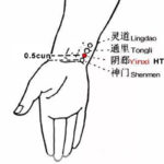 Diagram of inner wrist acupressure points including HT 6 (Yinxi), used for night sweats and hot flashes